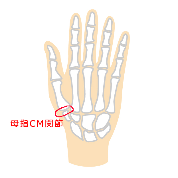 母指CM関節